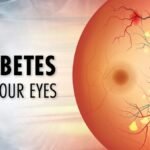 The Connection Between Diabetes and Eye Health