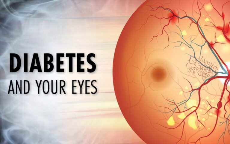 The Connection Between Diabetes and Eye Health